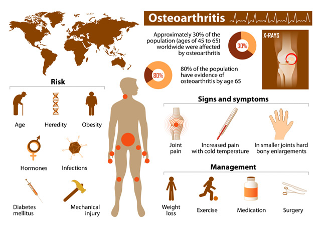 Risks, complications, and management of osteoarthritis may include vitamin K.