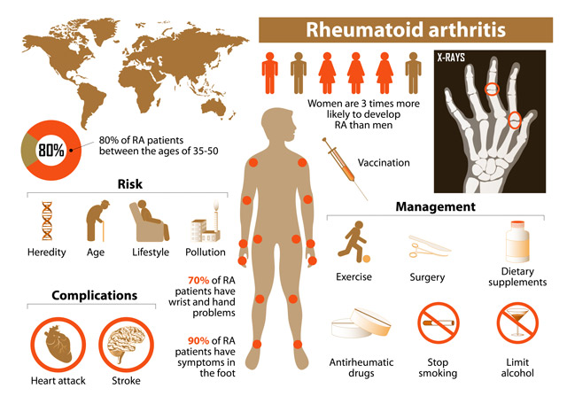 Risks, complications, and management of rheumatoid arthritis may include vitamin K.